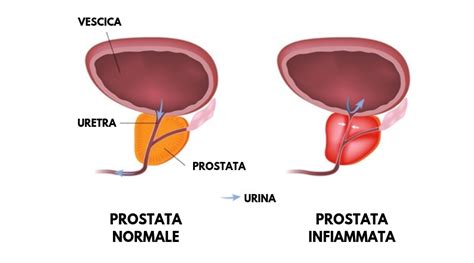 La prostata femminile: dove si trova